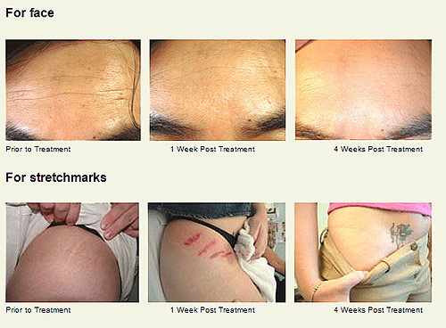 Laser Care Clinic Laser Care Clinic